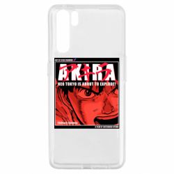 Чехол из раздела Акира Akira для Oppo A91/Reno3