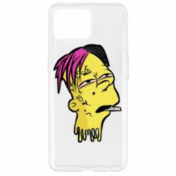 Чехол из раздела Hip Hop Bart as Lil Peep для Oppo Reno 4 Lite