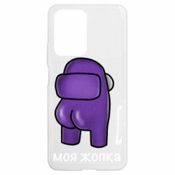Xiaomi 11T