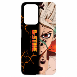 Чохол з розділу Доктор Стоун Доктор Стоун Арт для Xiaomi 11T - FATLINE Чохол з розділу Доктор Стоун Доктор Стоун Арт для Xiaomi 11T