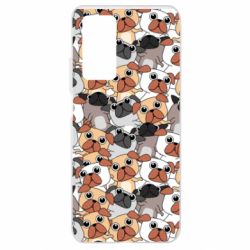 Xiaomi Mi 10T/10T Pro