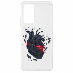 Xiaomi Mi 10T/10T Pro