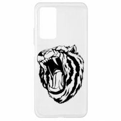 Xiaomi Mi 10T/10T Pro