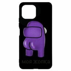 Xiaomi Mi11 Lite