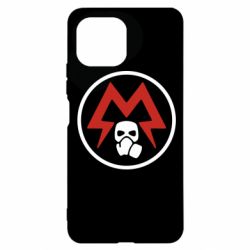 Xiaomi Mi11 Lite