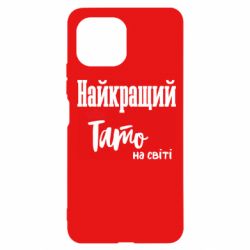 Xiaomi Mi11 Lite