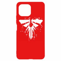 Xiaomi Mi11 Lite