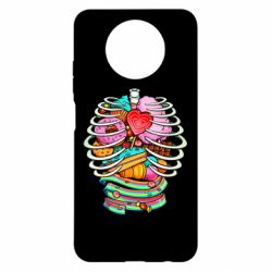 Чохол з розділу Печеньки Сandy inside the skeleton для Xiaomi Redmi Note 9 5G/Redmi Note 9T - FATLINE Чохол з розділу Печеньки Сandy inside the skeleton для Xiaomi Redmi Note 9 5G/Redmi Note 9T