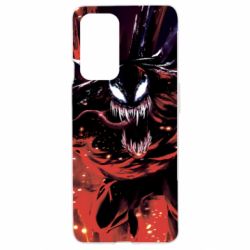 OnePlus 9
