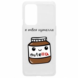 OnePlus 9