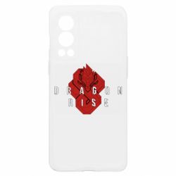 OnePlus Nord2 5G