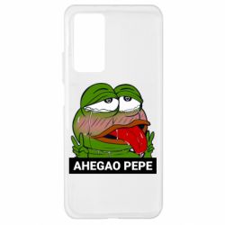 Xiaomi Mi 10T/10T Pro