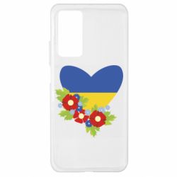 Xiaomi Mi 10T/10T Pro