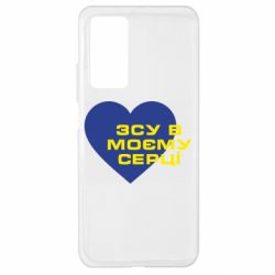 Xiaomi Mi 10T/10T Pro