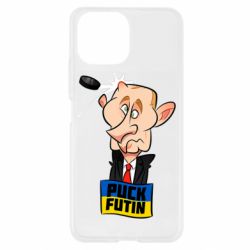 Xiaomi Mi11 Lite