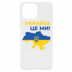 Xiaomi Mi11 Lite