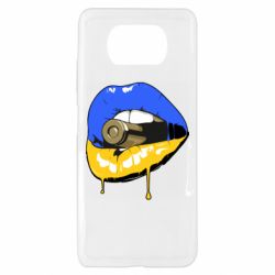 Xiaomi Poco X3
