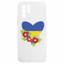 Xiaomi Redmi Note 10 5G