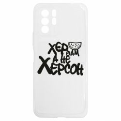 Xiaomi Redmi Note 10 5G