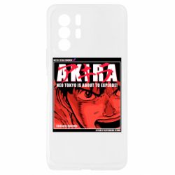 Xiaomi Redmi Note 10 Pro 5G