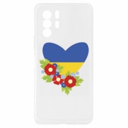 Xiaomi Redmi Note 10 Pro 5G