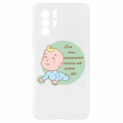 Xiaomi Redmi Note 10 Pro 5G