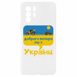 Xiaomi Redmi Note 10 Pro 5G