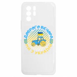 Xiaomi Redmi Note 10 5G