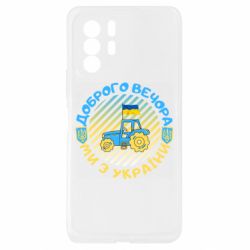 Xiaomi Redmi Note 10 Pro 5G