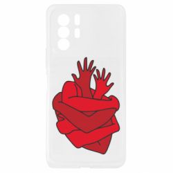 Xiaomi Redmi Note 10 Pro 5G