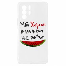 Xiaomi Redmi Note 10 Pro 5G