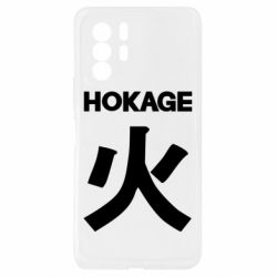 Xiaomi Redmi Note 10 Pro 5G