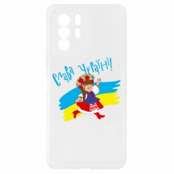 Xiaomi Redmi Note 10 Pro 5G