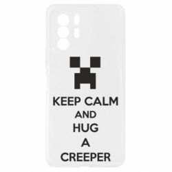 Xiaomi Redmi Note 10 Pro 5G