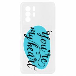 Xiaomi Redmi Note 10 Pro 5G