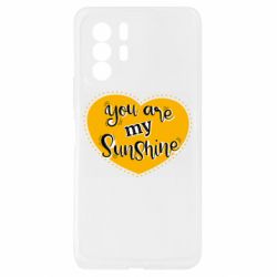 Xiaomi Redmi Note 10 Pro 5G