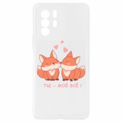 Xiaomi Redmi Note 10 Pro 5G