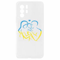 Xiaomi Redmi Note 10 Pro 5G