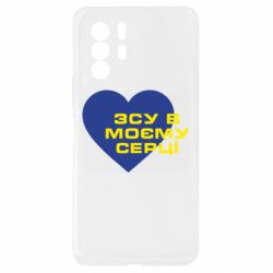 Xiaomi Redmi Note 10 Pro 5G