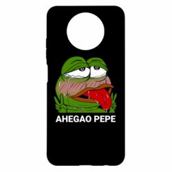 Чохол з розділу Ahegao Аhegao PePe для Xiaomi Redmi Note 9 5G/Redmi Note 9T - FATLINE Чохол з розділу Ahegao Аhegao PePe для Xiaomi Redmi Note 9 5G/Redmi Note 9T