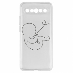 Meizu 17/17 Pro