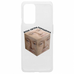 OnePlus 9
