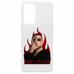 OnePlus 9