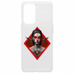 OnePlus 9