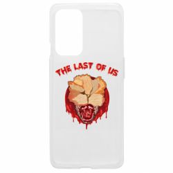 Чехол из раздела Авторские принты The Last Of Us щелкун для OnePlus 9 - FATLINE Чехол из раздела Авторские принты The Last Of Us щелкун для OnePlus 9