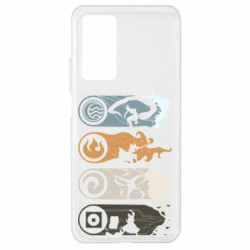 Xiaomi Mi 10T/10T Pro