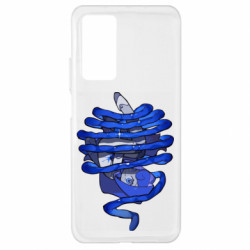 Xiaomi Mi 10T/10T Pro