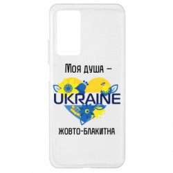 Xiaomi Mi 10T/10T Pro