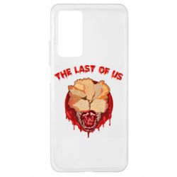 Xiaomi Mi 10T/10T Pro