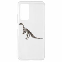 Xiaomi Mi 10T/10T Pro